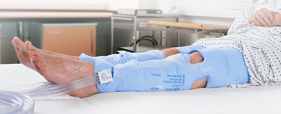 patient wearing IPC stockings