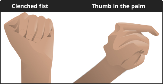 diagram of hand gestures: clenched fist and thumb in the palm