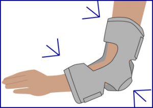 Elbow and hand orthoses - CHSS eLearning