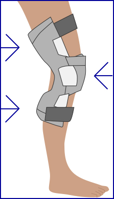 three-point knee orthosis diagram showing support for back of upper leg, back of lower leg, and front of knee joint