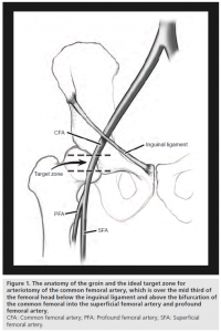 Figure 1: Anatomy of the groin