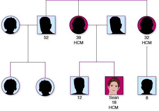 Cascade screening of Sean's first degree relatives for HCM