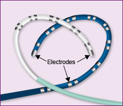 EPS catheters