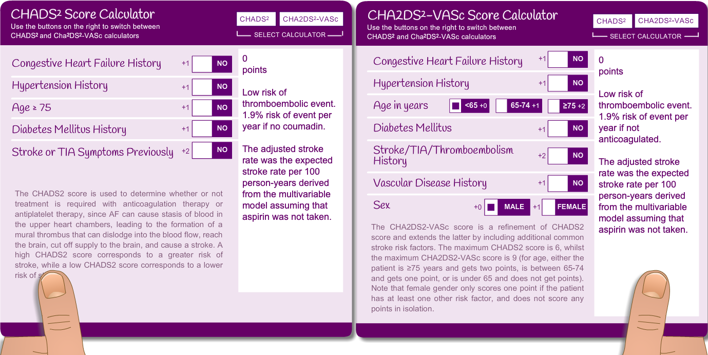 Dillon's stroke risk using CHADS
