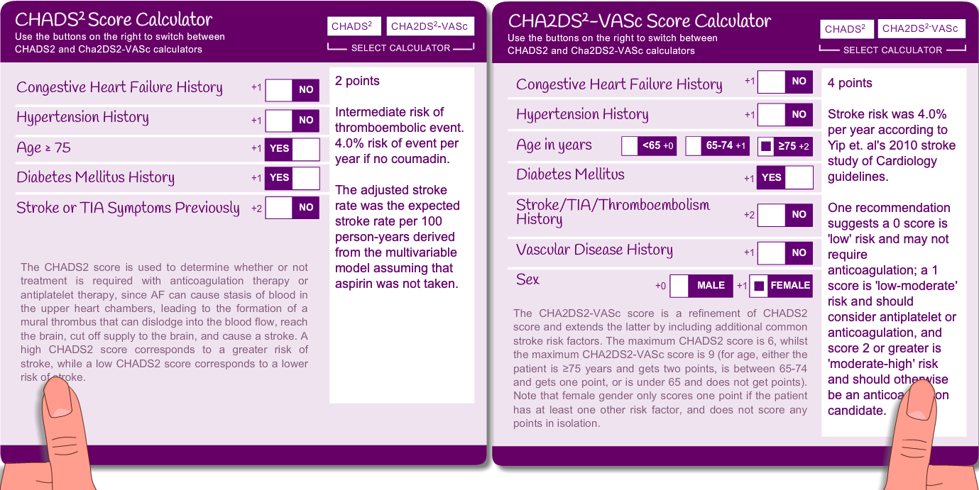 Sally's CHADS results