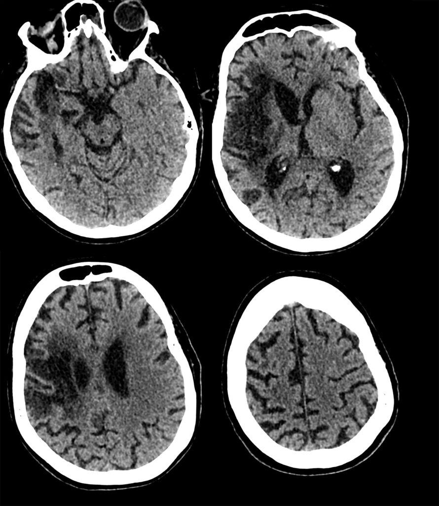 Case 05 CT