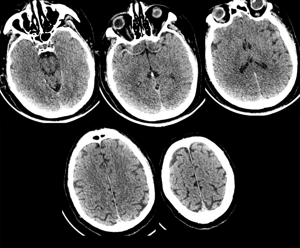 Case 06 CT