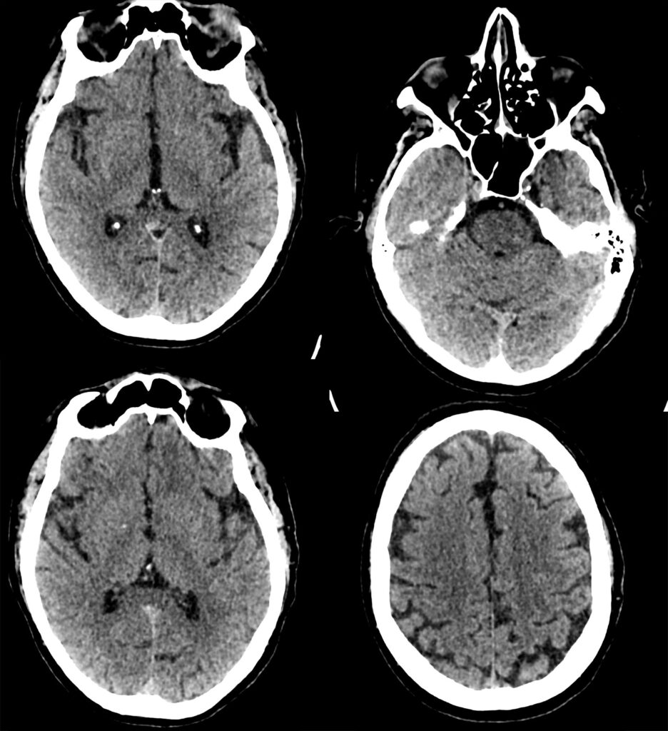 Case 07 CT