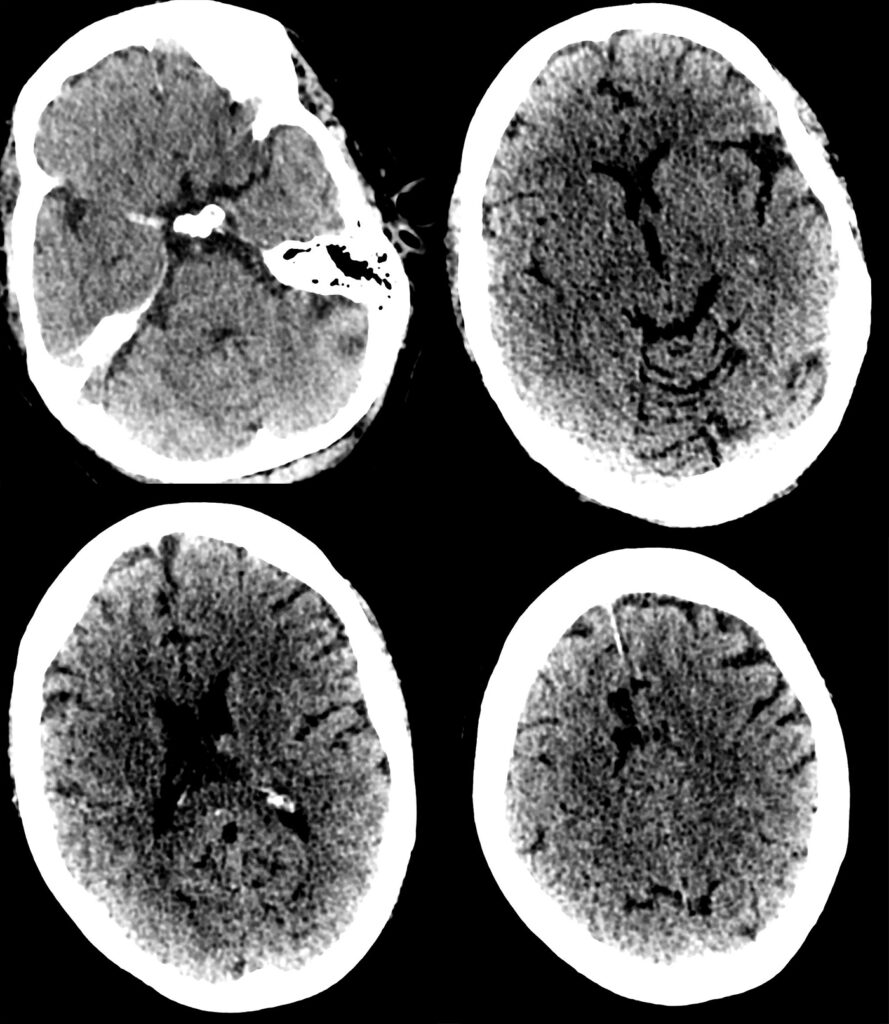 Case 08 CT