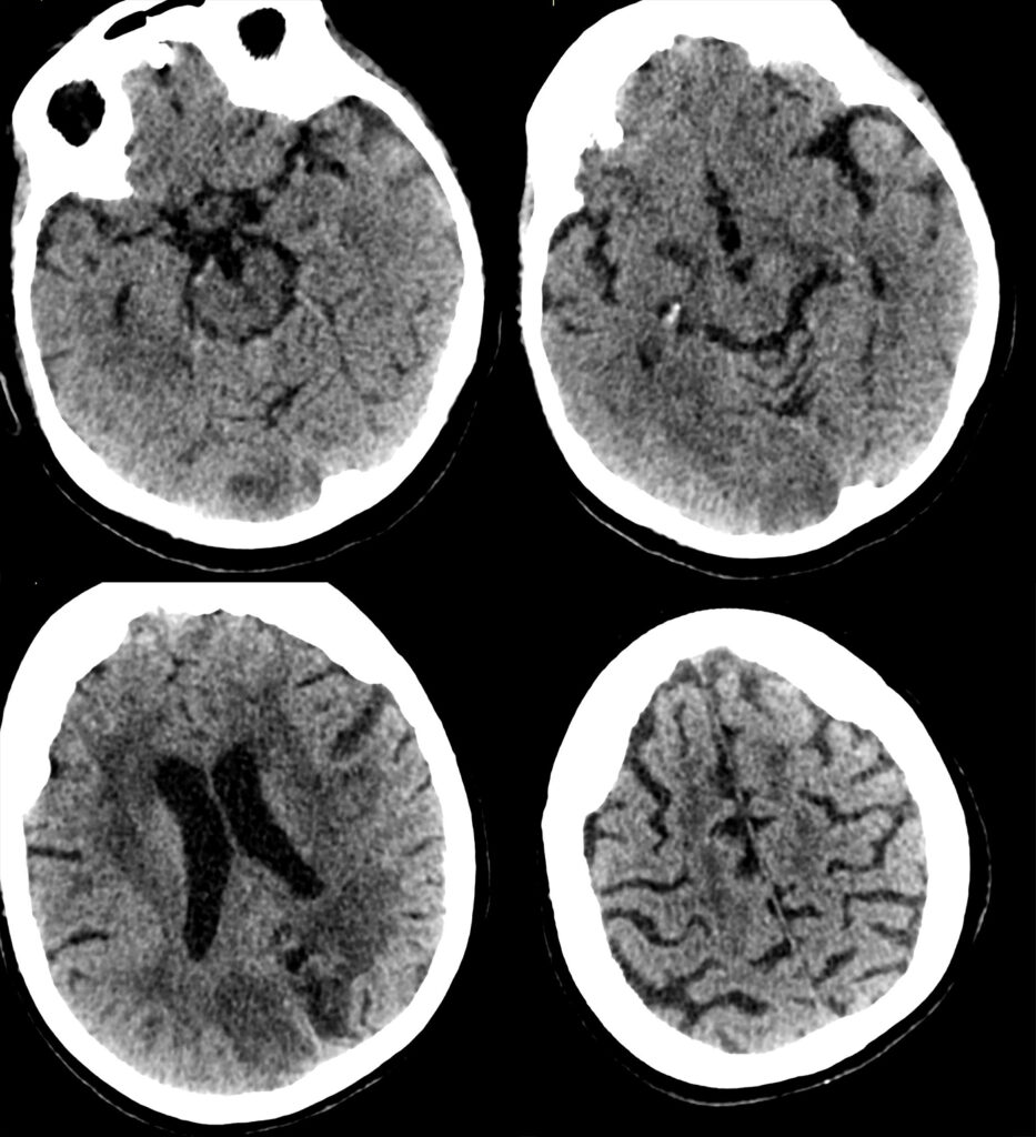 Case 09 CT