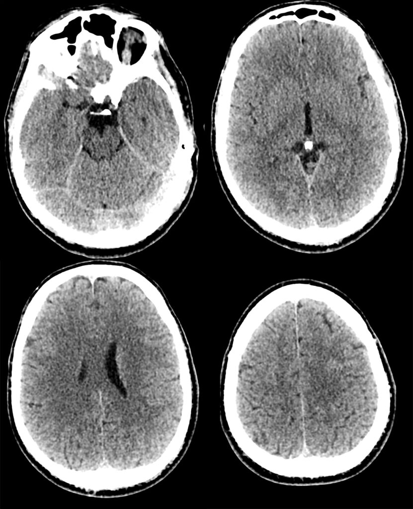 Case 12 CT